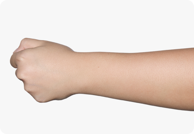 Effect after using the arm